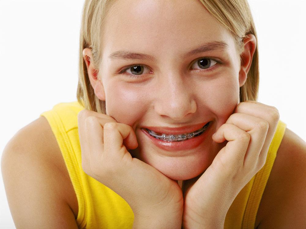 牙齒矯正需要多長時間？